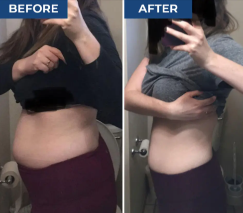 PuraBurn benefits